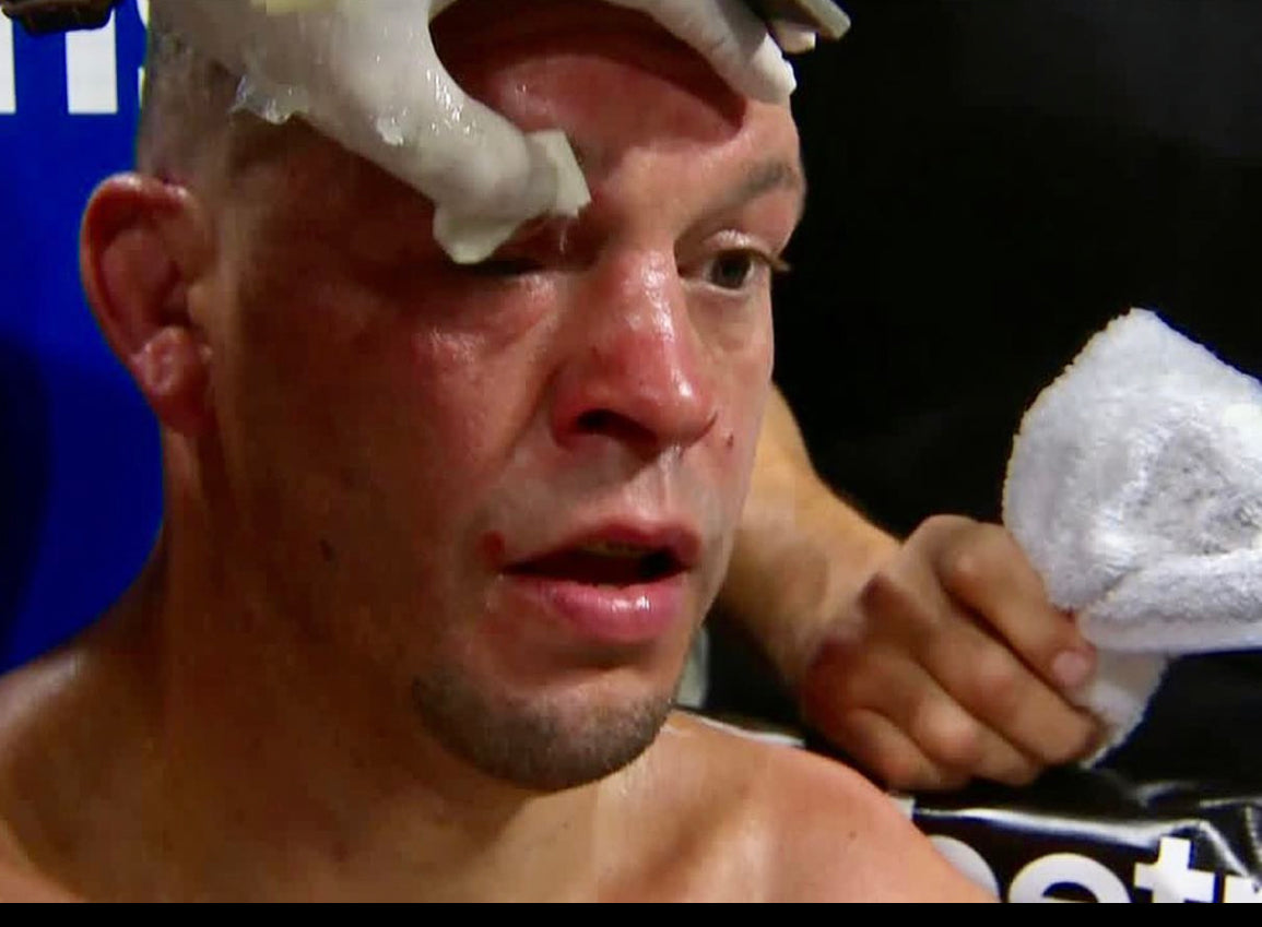 Qwick-Aid being used on Nate Diaz 