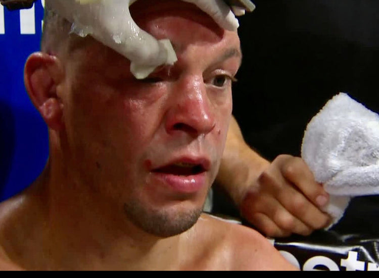 Qwick-Aid being used on Nate Diaz 